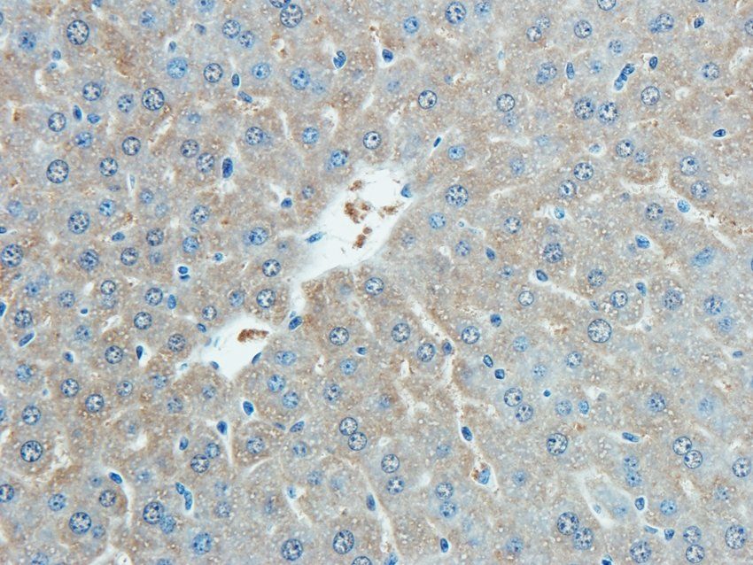 CD38 antibody