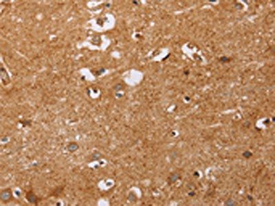 CD38 Antibody