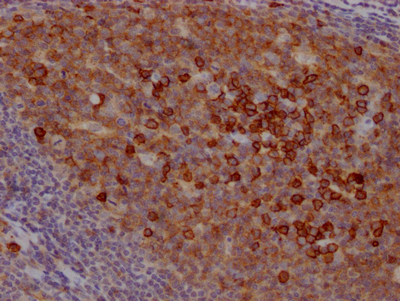 CD38 Recombinant Monoclonal Antibody