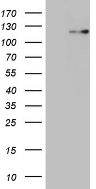 CD39 (ENTPD1) antibody