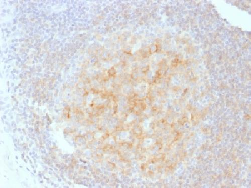 CD40 / TNFRSF5 / CD40L-Receptor Antibody