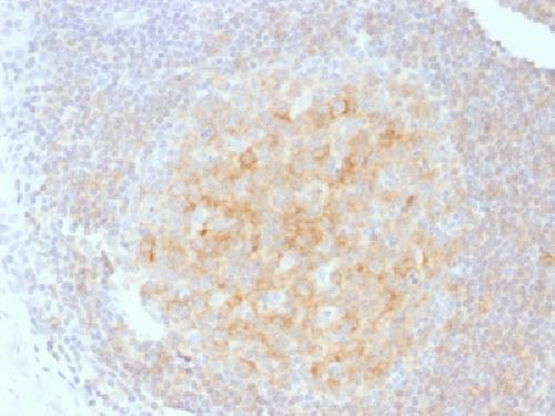 CD40 antibody