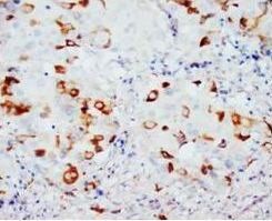 Anti-CD40L/CD40LG Antibody