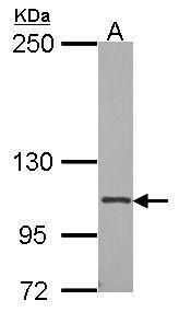 CD41 Rabbit Polyclonal Antibody