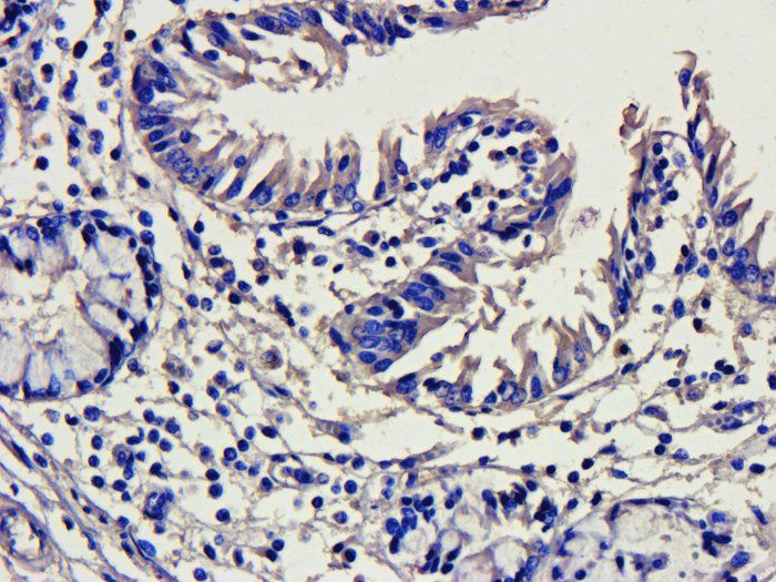 CD41 Rabbit Polyclonal Antibody