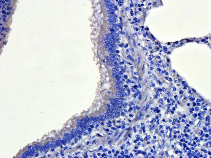 CD41 Antibody