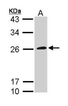 CD42c antibody