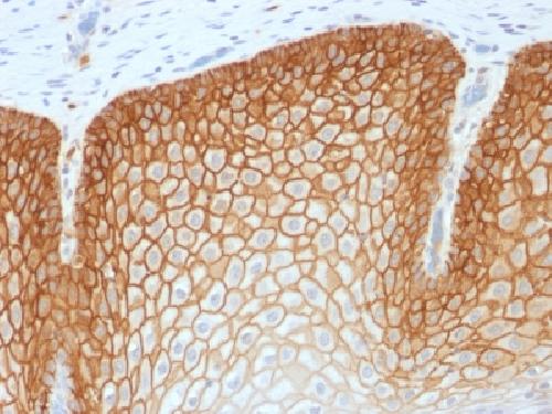 Recombinant CD44v4 (Marker of Tumor Metastasis) Antibody