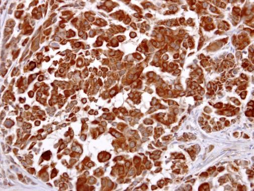 LHR antibody [C3], C-term