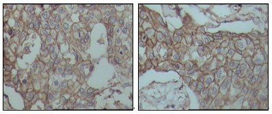 CD44 Antibody