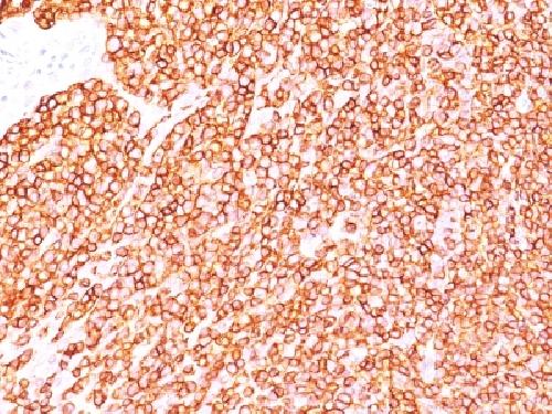 CD45 / LCA (Leucocyte Marker) Antibody