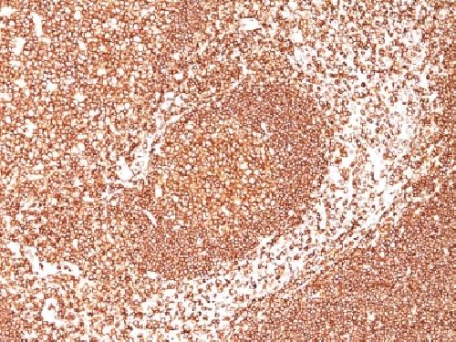 CD45 / LCA (Leucocyte Marker) Antibody