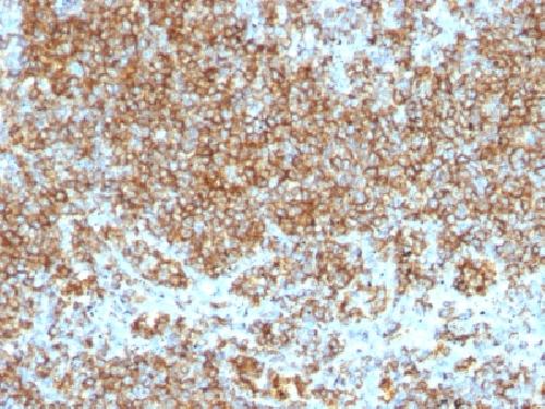 CD45 antibody