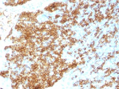 CD45 antibody