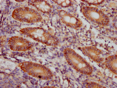 CD46 Recombinant Monoclonal Antibody