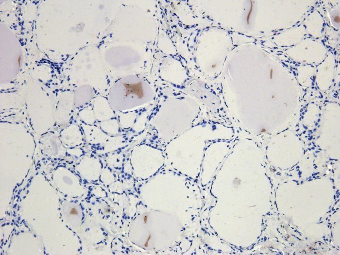 CD4 Rabbit Polyclonal Antibody