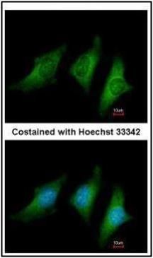 CD55 Rabbit Polyclonal Antibody