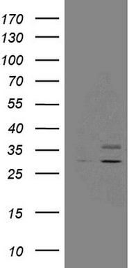 CD56 (NCAM1) antibody