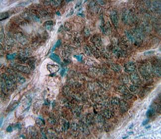 Mouse anti Human CD56 Prediluted