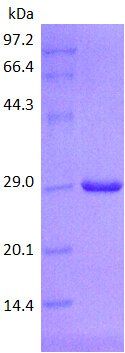 CD56 protein