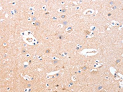 B3GAT1 Antibody