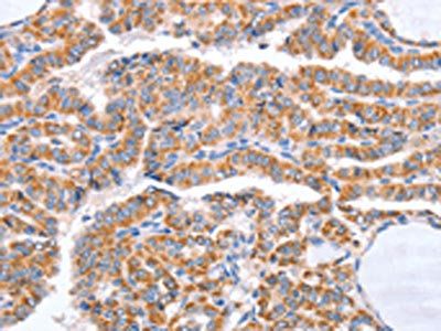 B3GAT1 Antibody