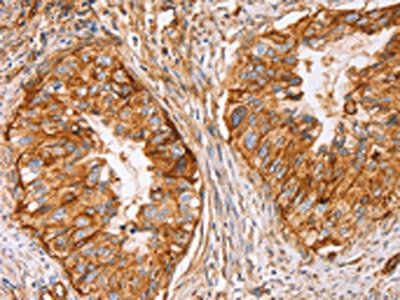 CD59 Antibody