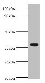 CD5L antibody