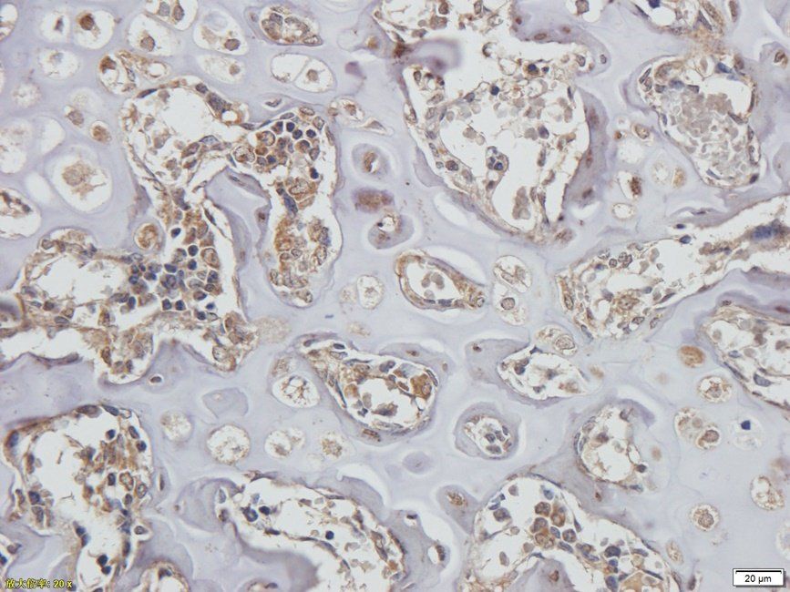 CD62E antibody