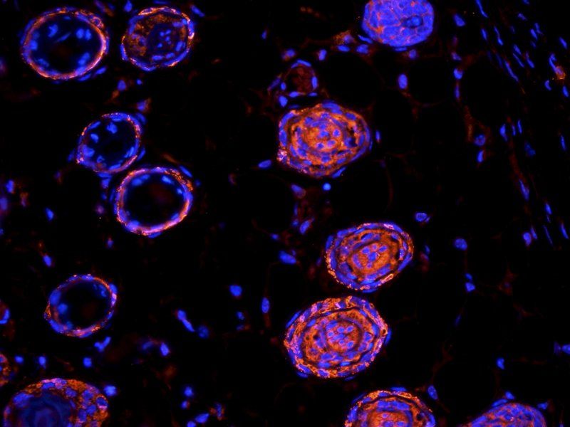 CD63 antibody