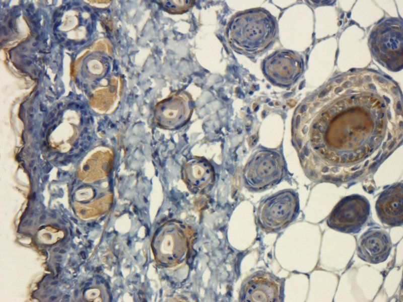 CD63 Rabbit Polyclonal Antibody