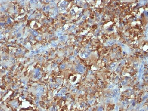 CD68 (Macrophage Marker) Antibody