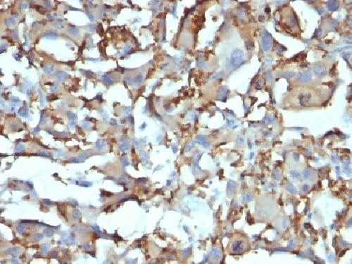 CD68 (Macrophage Marker) Antibody