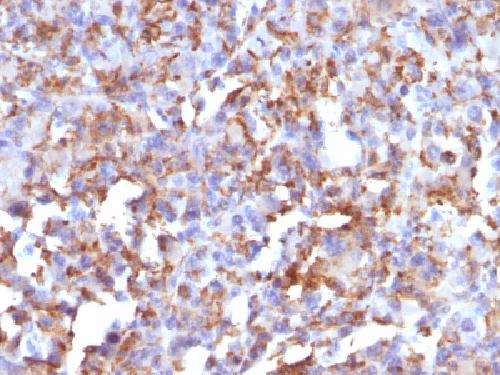 CD68 (Macrophage Marker) Antibody