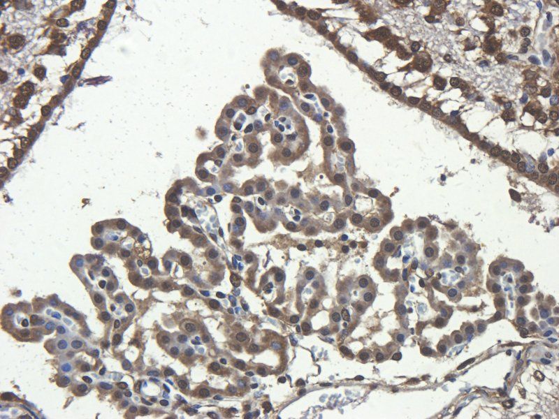 CD68 antibody