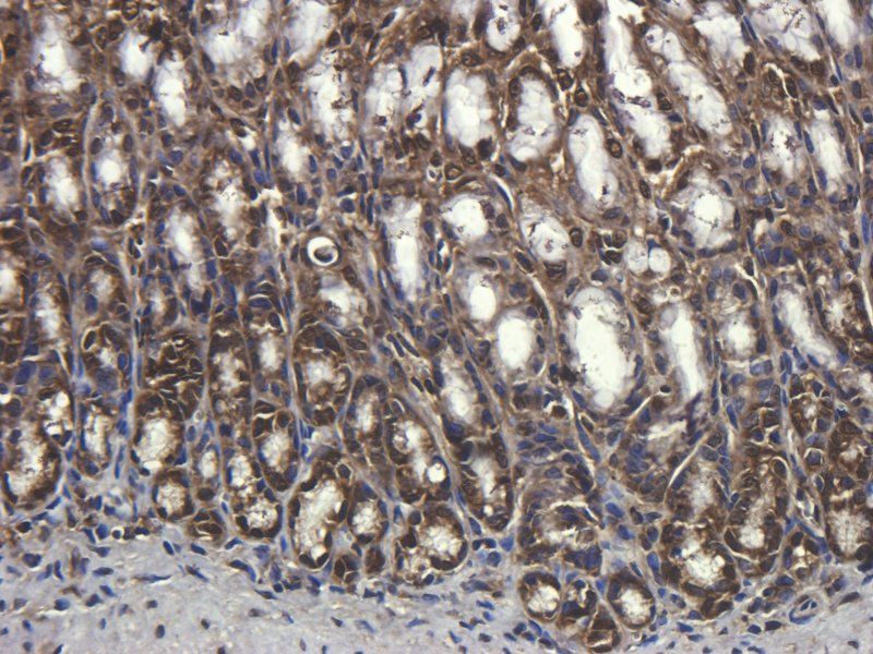 CD68 Rabbit Polyclonal Antibody
