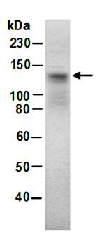 CD6 antibody