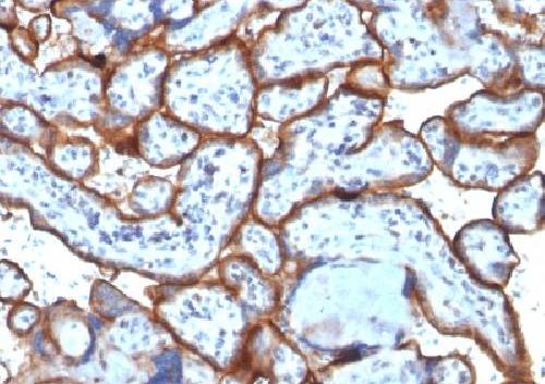 CD71 / Transferrin Receptor (TFRC) (Extracellular Domain) Antibody