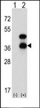 CD72 antibody