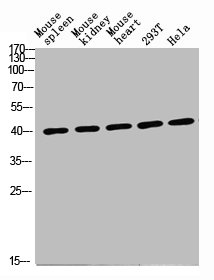 CD72 antibody