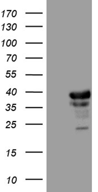 CD73 (NT5E) antibody