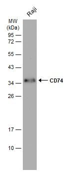 CD74 Rabbit Polyclonal Antibody
