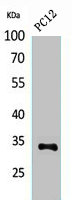 CD74 antibody