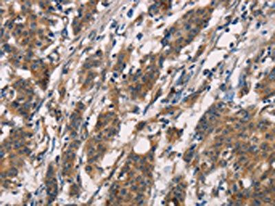CD80 Antibody