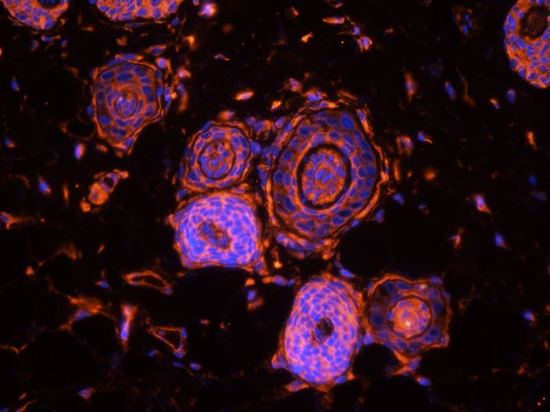 CD81 antibody