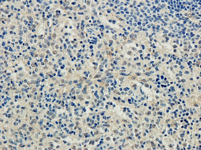CD83 Rabbit Polyclonal Antibody
