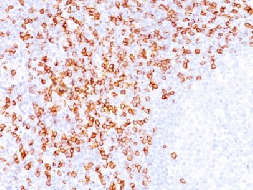 CD8A antibody