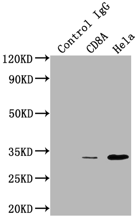 CD8A antibody