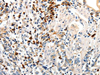 CD93 Antibody