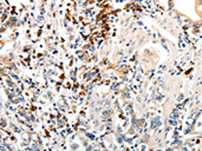 CD93 antibody